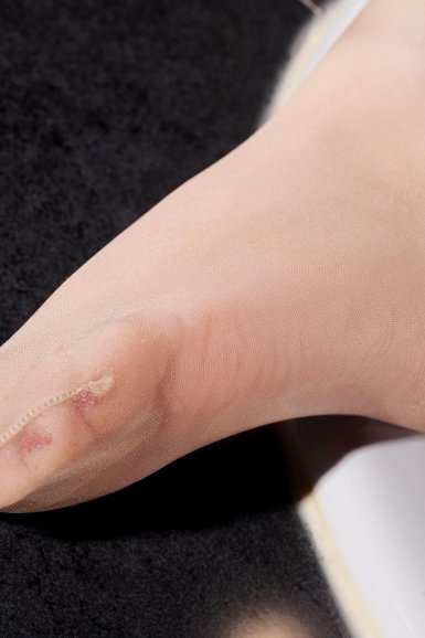 星空体育app公司|胶原蛋白肽招商 延缓衰老(图2) 星空体育app公司